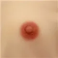 3cm Areola