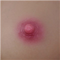 Pink Areola